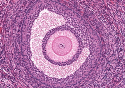 Pathology Slide
