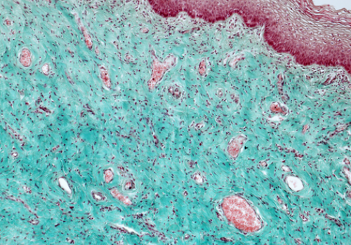 Pathology Slide