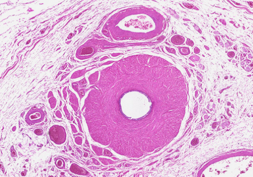 Pathology Slide