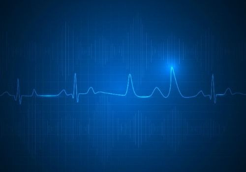 ECG