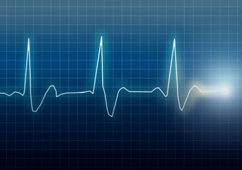 ECG