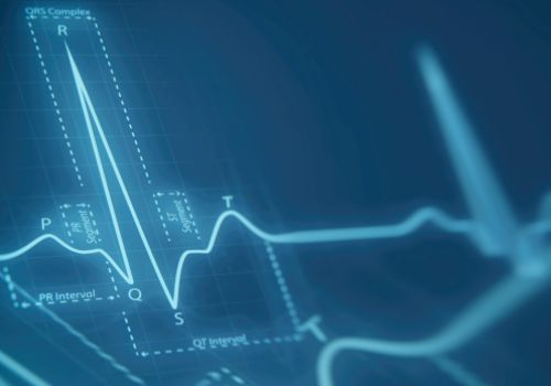 ECG