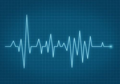 ECG