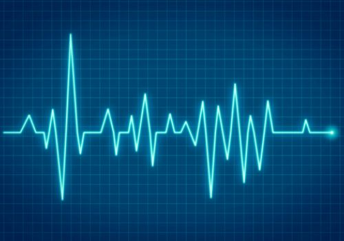 ECG