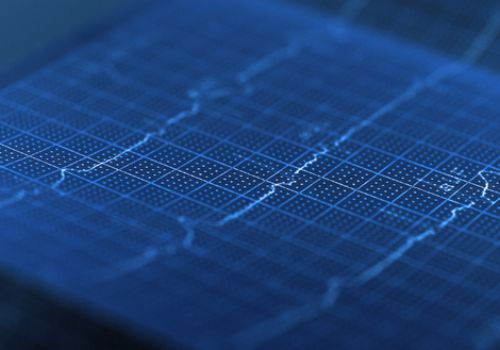 ECG