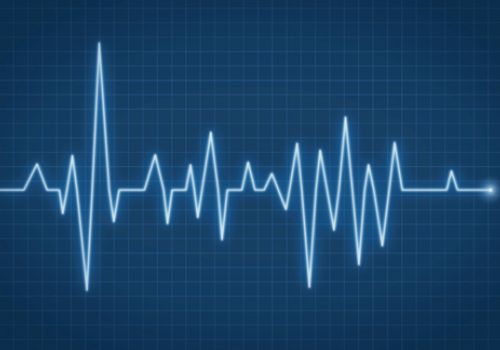 ECG
