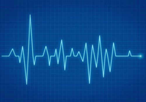 ECG