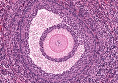 Pathology Slide