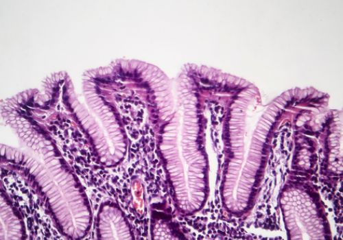 pathology slide