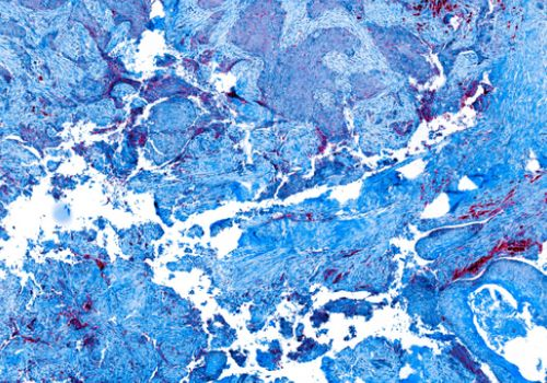 Pathology Slide