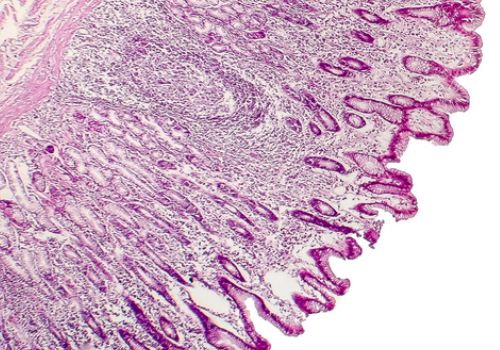 Pathology Slide