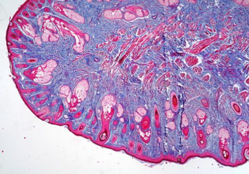 Pathology Slide