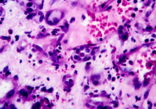 Pathology Slide
