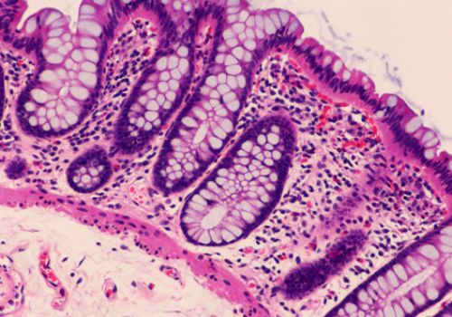 histological slide
