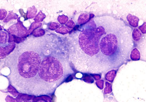 Cancer cells