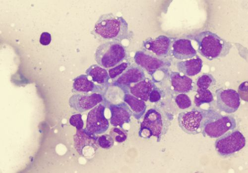 Cancer cells