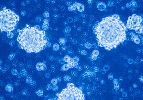 Cancer cells