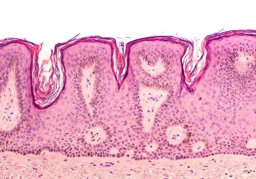 Skin biopsy micrograph