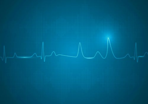ECG