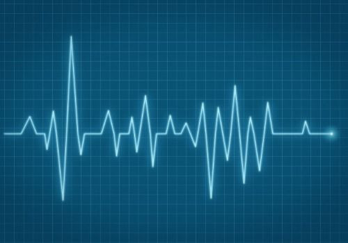ECG