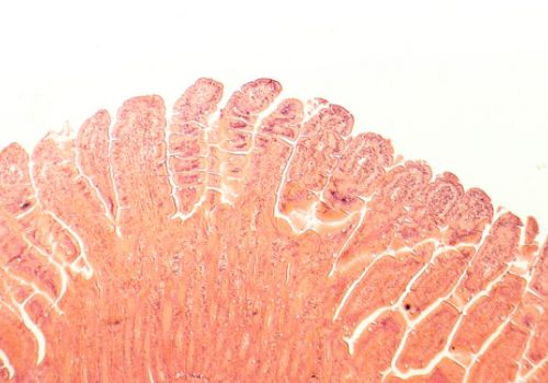 Villi