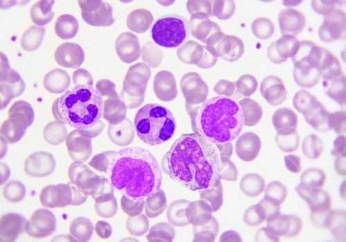 Pathology Slide