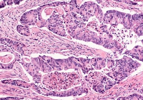 Pathology Slide