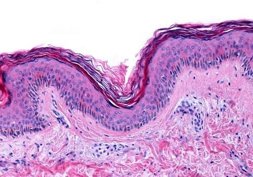 Pathology Slide