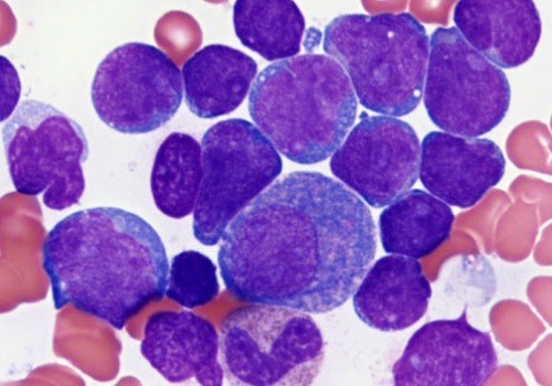 FRCPath in Haematology – an overview