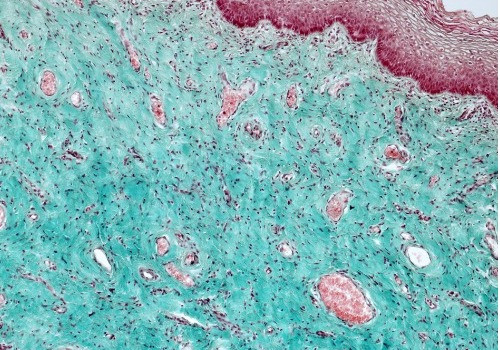 Pathology Slide